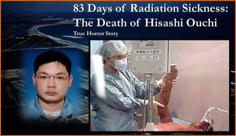 **The Remarkable Journey Of Hisachi Ouchi After Radiation**