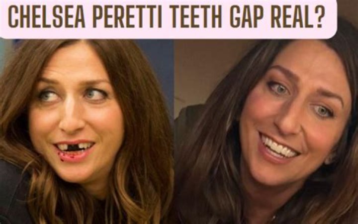Unveiling The Truth: Does Chelsea Peretti Have Fake Teeth?