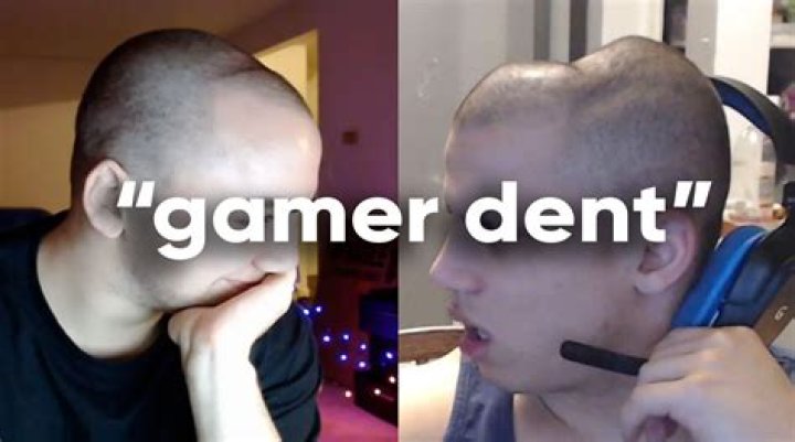Unveiling The Mystery Of Gamer Dent: The New Wave In Gaming Culture