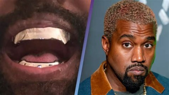 Kanye West's Dazzling Smile: An In-Depth Look At His Teeth