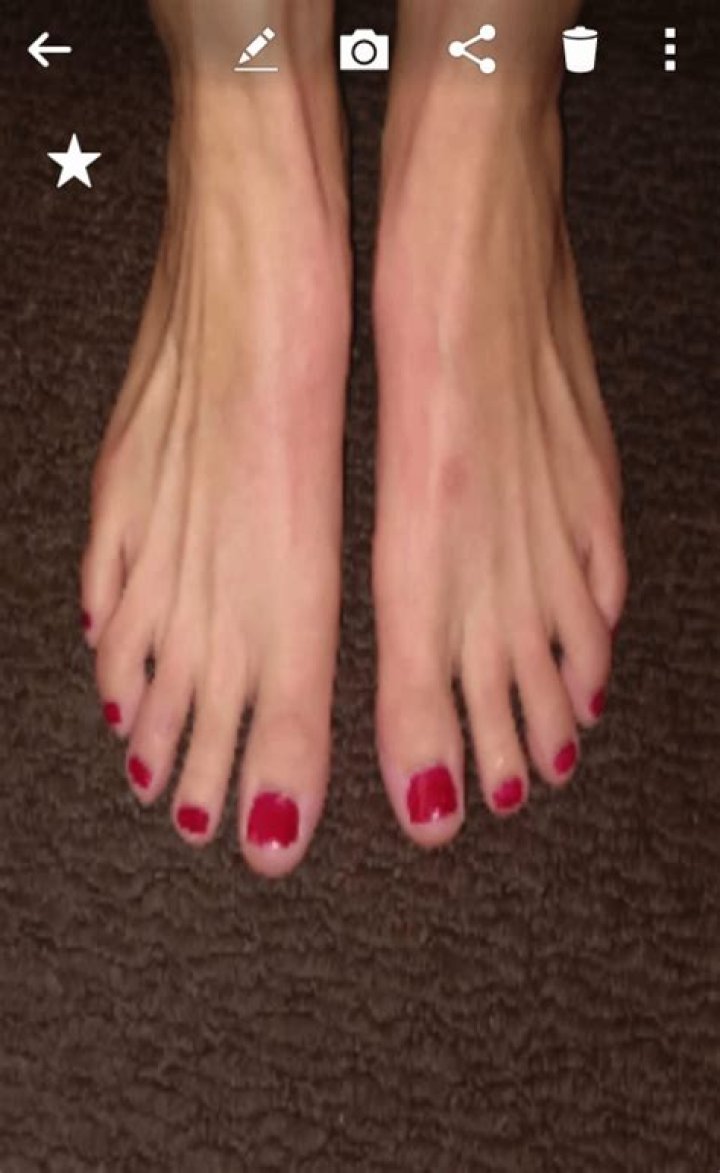 Understanding Moms Feet: The Stories They Tell