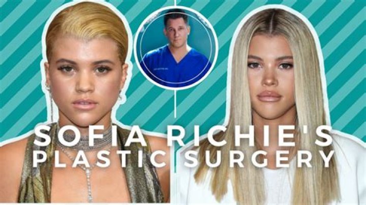 Sofia Richies Plastic Surgery Transformation: Before And After