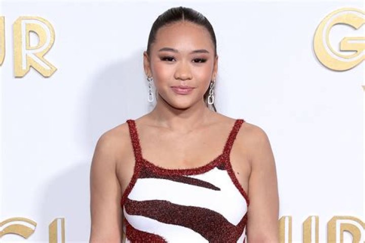 Unveiling The Truth Behind Suni Lee's Face Surgery: What We Know