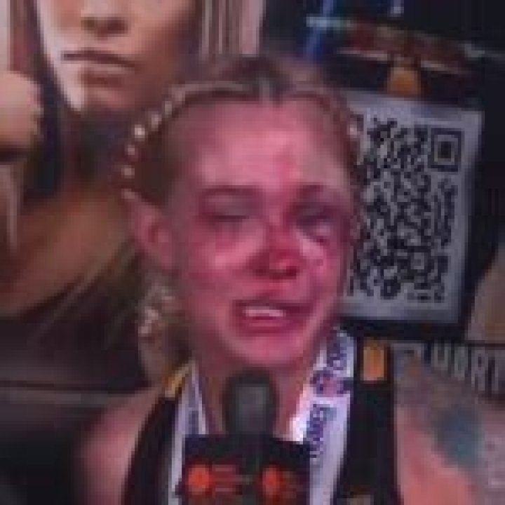 Taylor Starling Meme: The Rise Of A Viral Sensation