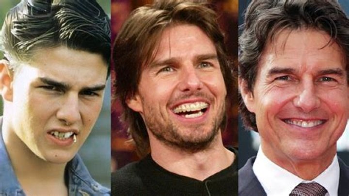Unveiling The Mystery Of Tom Cruise's Teeth